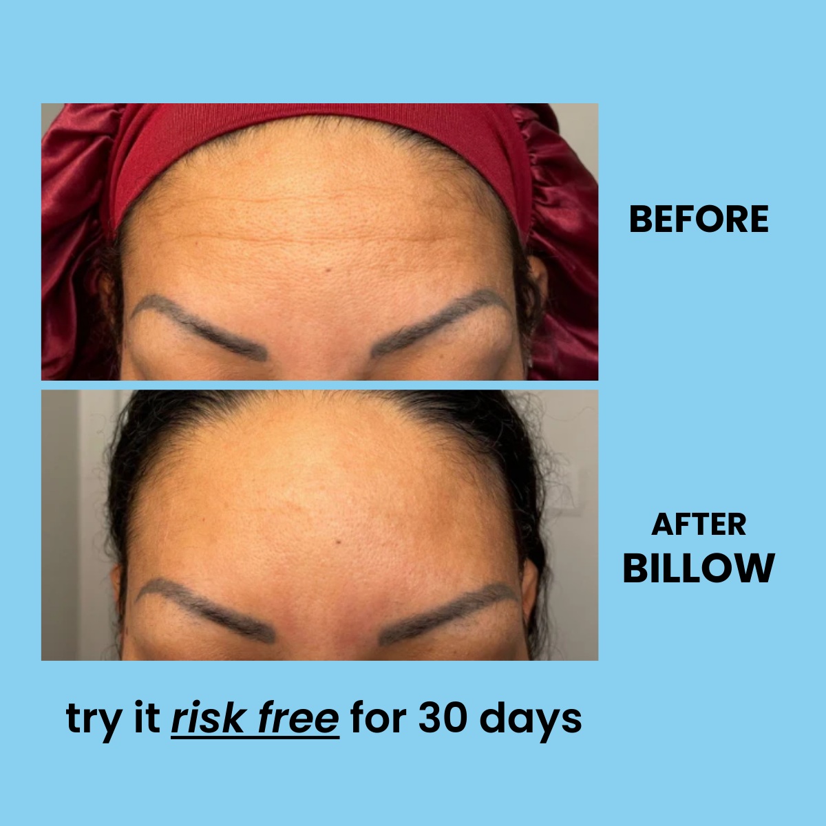 Forehead Anti-Wrinkle Mask